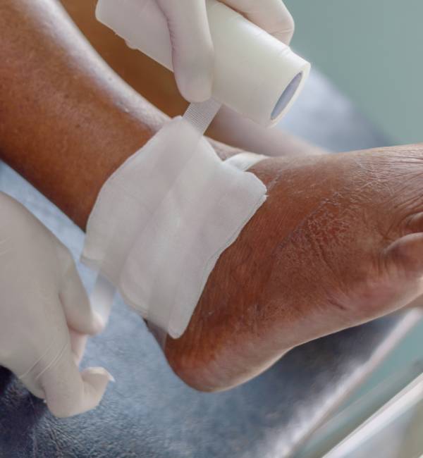 Foot being bandaged with white gauze.